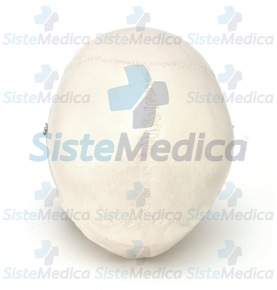 Cráneo con cerebro