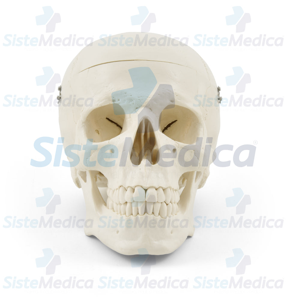 Craneo sin cerebro
