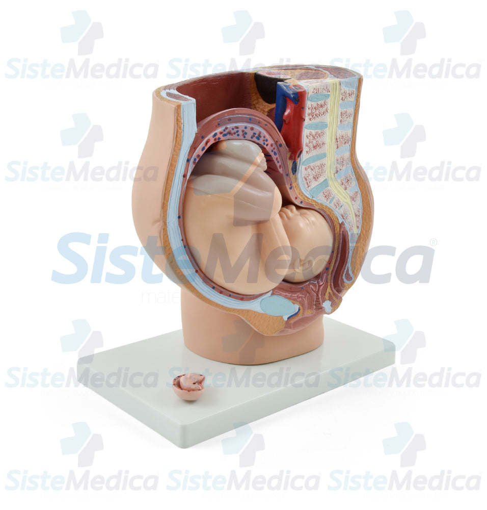 Pelvis de embarazo con feto