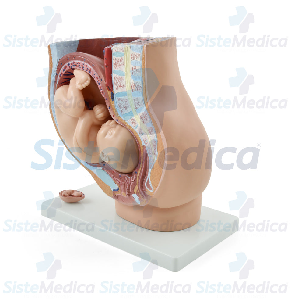 Pelvis de embarazo con feto